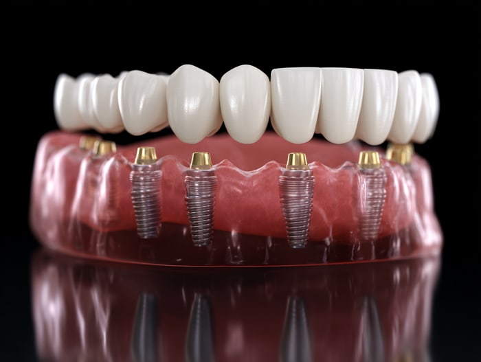 Implantate